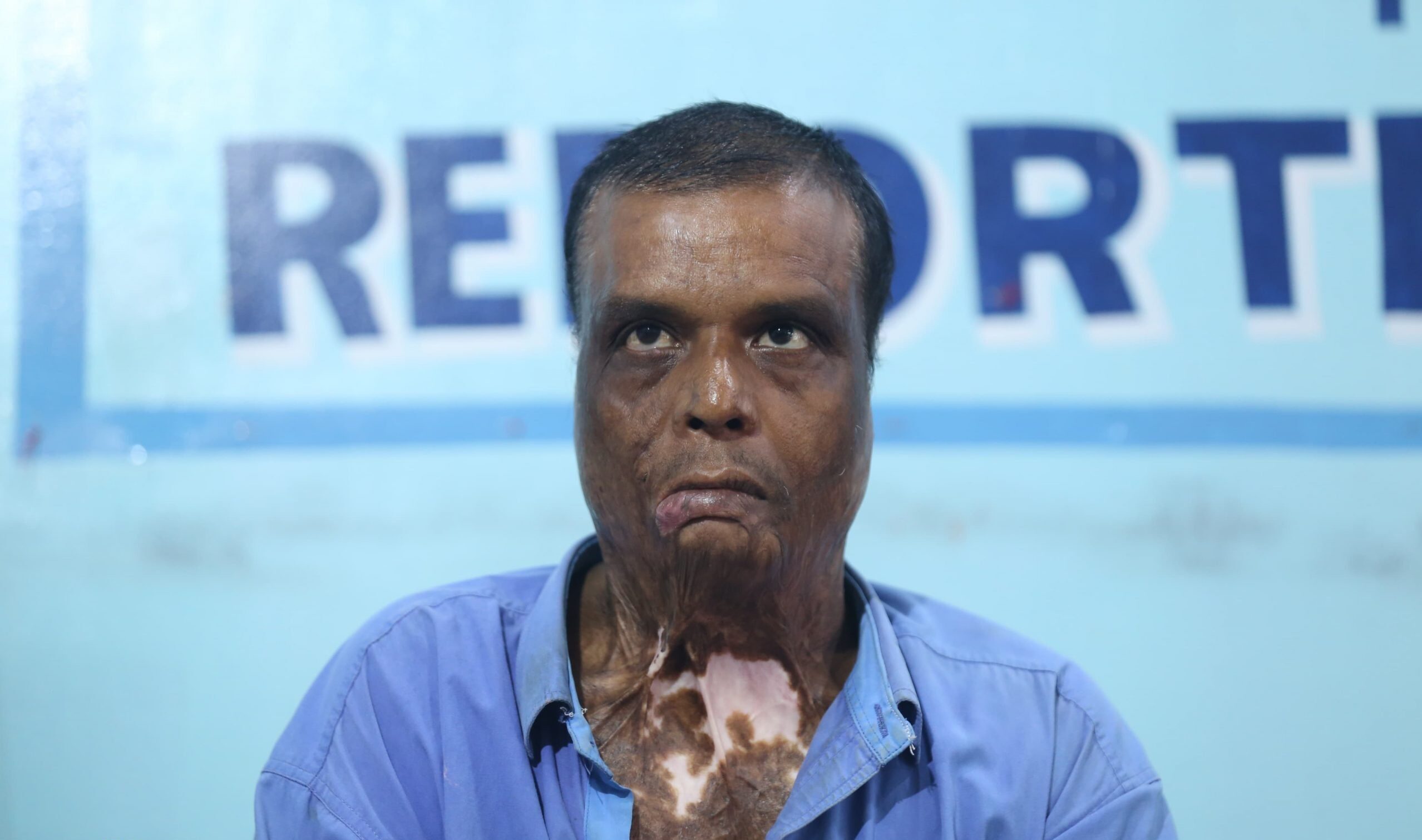 पीडितले भने- बम आलमकै घरमा पड्किएको थियो